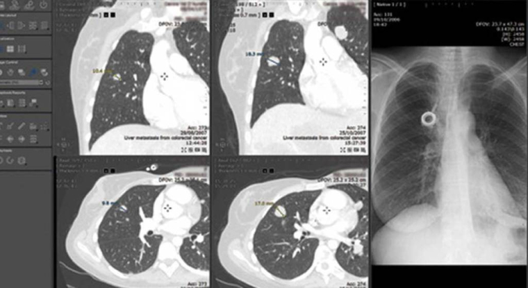 Intrasense est spécialisé dans les logiciels de visualisation et d'analyse d'images médicales. (© Intrasense)