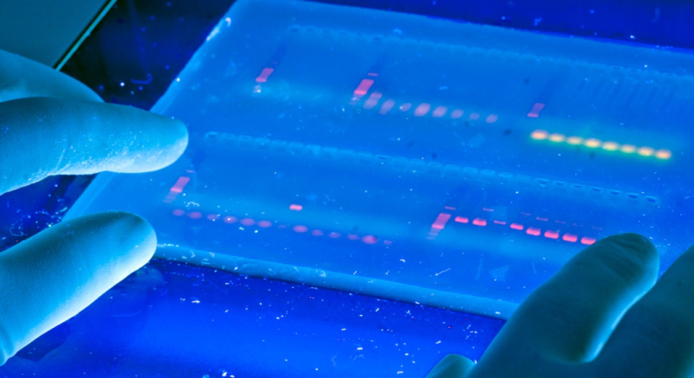 Byophytis va mener une étude «pilote» visant à définir les critères de sélection et d’inclusion des patients atteint de sarcopénie, des deux cotés de l’Atlantique. (© University of Michigan)